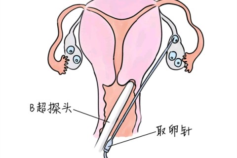 http://zhuhai.vdtfzz.com/post/205.html|珠海供卵助孕