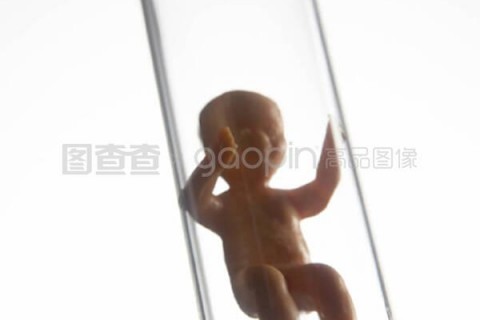 http://zhuhai.vdtfzz.com/post/197.html|珠海试管助孕